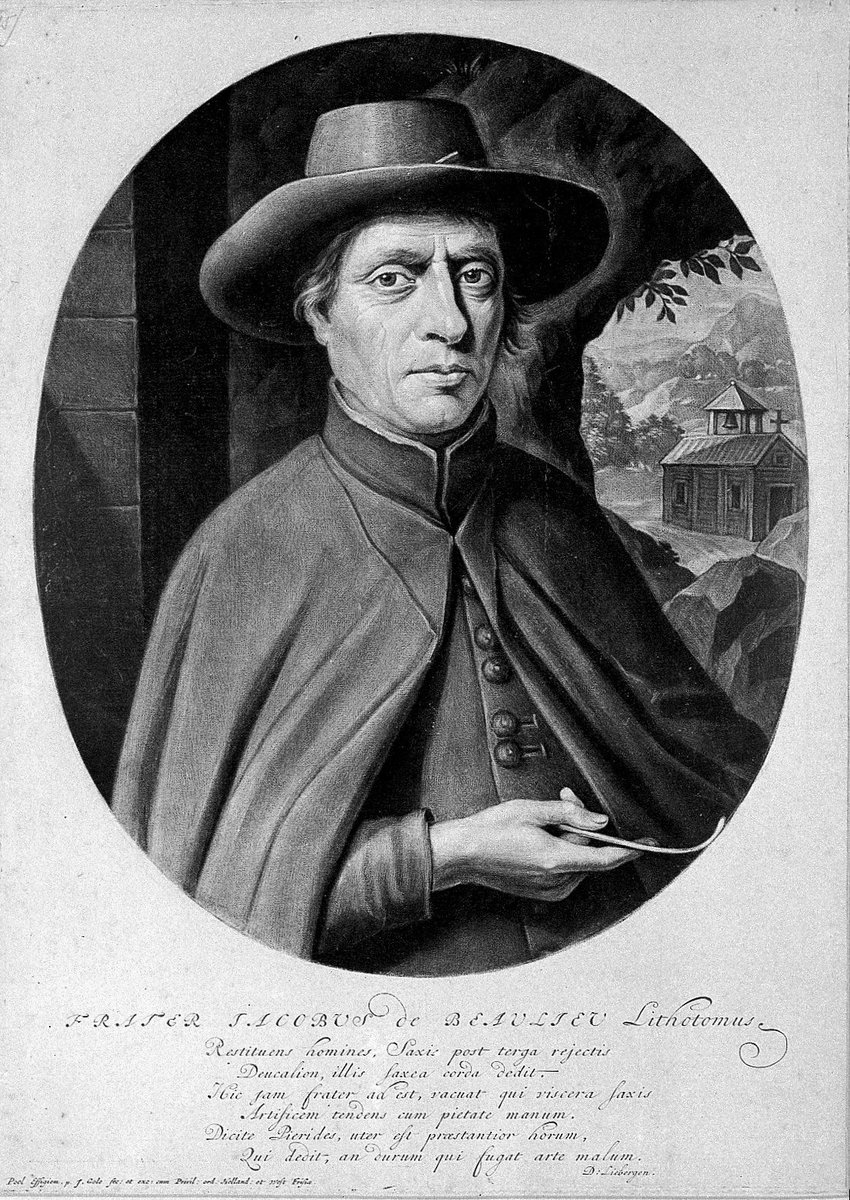 kjdelay1's tweet photo. When I start a case in the OR i try to remember that I am stepping into a role that is ancient: the surgeon. 

Urology has a unique set of forebears like any specialty

Frère Jacques was performing lithotomies in 18th-century France with little more than a knife, his hands, and a remarkable amount of gusto . A little over a century ago, Hugh Hampton Young was building modern urology at Johns Hopkins, creating instruments and techniques because they simply didn’t exist yet. He made the specialty 

They didn’t have CT scans, antibiotics, robotics, yet they did what I strive for today. They used the resources available and their knowledge to help a patient in need. 

Medicine is infinitely  complex now but the goal is the same .

I try to remind myself in the middle of the busy days what a privilege it is to be part of this heritage