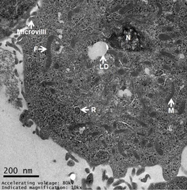 Landmark_IMR's tweet photo. 🔍Exploring stem cell dynamics in Beetal goats! 🧬

🔬New in FBL! Researchers successfully cultured GMESCs, creating a robust new model for mammary tissue repair and intramammary infections.  

👉 Read: https://t.co/sG8j5kpf1I  

#StemCells #VetMed #CellCulture https://t.co/JA6mGSWnFM