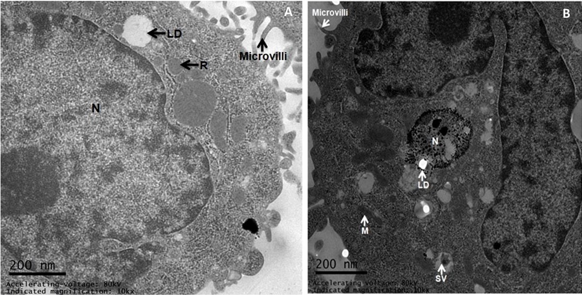 Landmark_IMR's tweet photo. 🔍Exploring stem cell dynamics in Beetal goats! 🧬

🔬New in FBL! Researchers successfully cultured GMESCs, creating a robust new model for mammary tissue repair and intramammary infections.  

👉 Read: https://t.co/sG8j5kpf1I  

#StemCells #VetMed #CellCulture https://t.co/JA6mGSWnFM