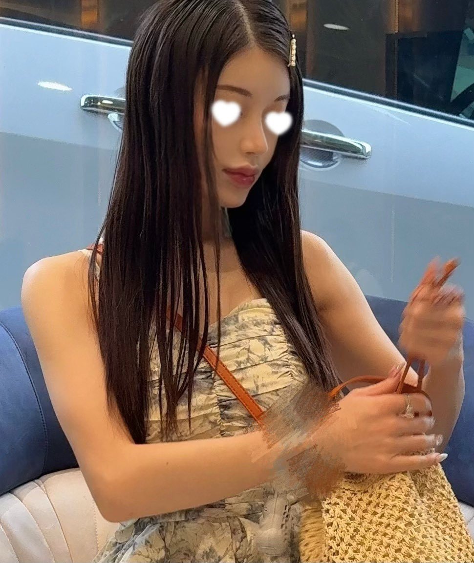Oci13V's tweet photo. 🇰🇷ギリン美容外科で鼻フル＋目の下脂肪再配置 を受けて約半年経ちました。

仕上がりがとても自然で、違和感なく日常生活を過ごせています！😸

横顔のラインも前より綺麗になり、周りから褒められることが増えました✨
今回お願いして本当に良かったです！🤍 https://t.co/WvwOgi5MOT