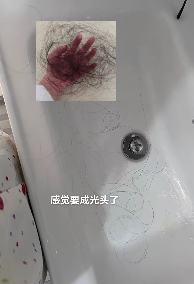 kAngieRoberbdnh's tweet photo. 也许有一天我会变成秃子 ＃女高 https://t.co/FkUSzET2cL
