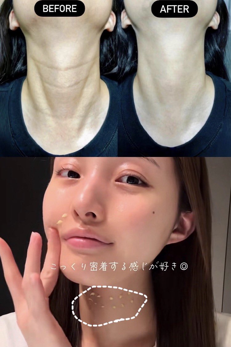 linneaabyrd's tweet photo. 待って首の皺は絶対これ‼️本気で首の皺悩みに直撃で神。美人皮膚科医の言うこと間違い無いですからwwwwレチノールよりレチナールです。 https://t.co/TUCqHhvLWa