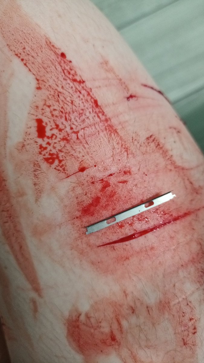 Dumbnmuzzled's tweet photo. Couple of good ones, multiswiping where would I be without u!! Can't wait to get drunk this weekend. Messy as shit because I'm an idiot. https://t.co/sFKtQKNNzv