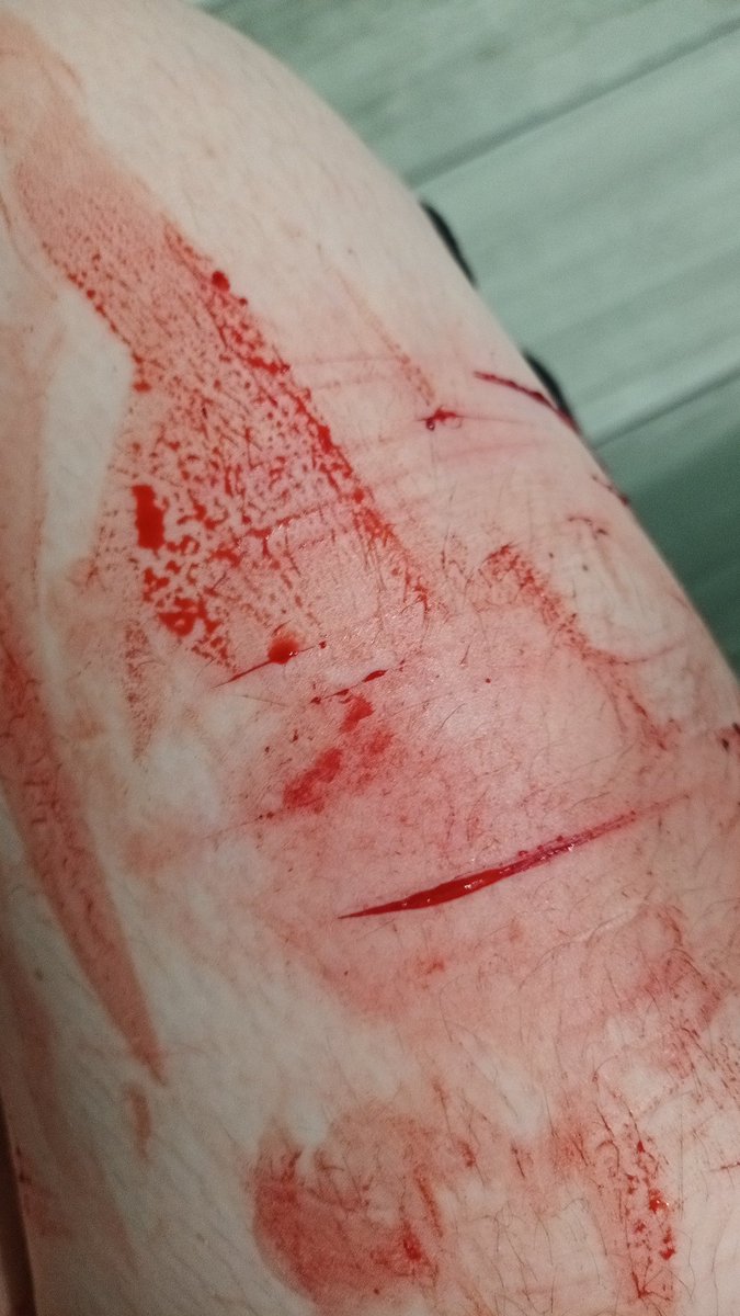 Dumbnmuzzled's tweet photo. Couple of good ones, multiswiping where would I be without u!! Can't wait to get drunk this weekend. Messy as shit because I'm an idiot. https://t.co/sFKtQKNNzv