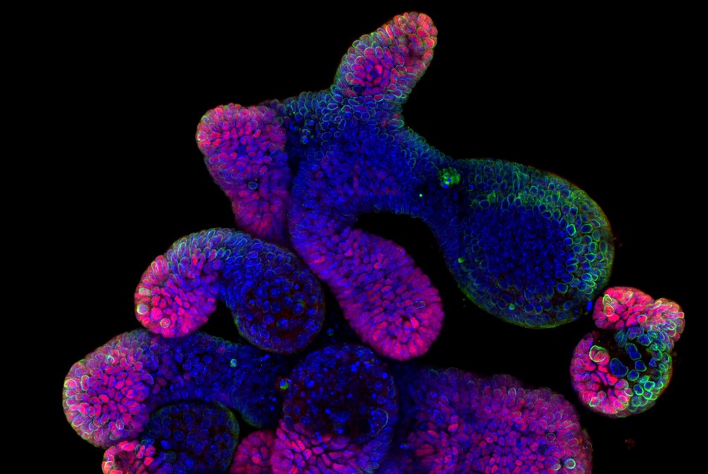 UdL_RDI's tweet photo. 🆕 Un compost derivat d'una planta medicinal protegeix l'epiteli intestinal davant la malaltia inflamatòria intestinal, que engloba la malaltia de Crohn i la colitis ulcerosa. Així ho ha descobert un estudi liderat per la @UdL_info i l'@IRBLleida_Info.

👉 https://t.co/h2mNscNTWq https://t.co/ixYJWs4uFC