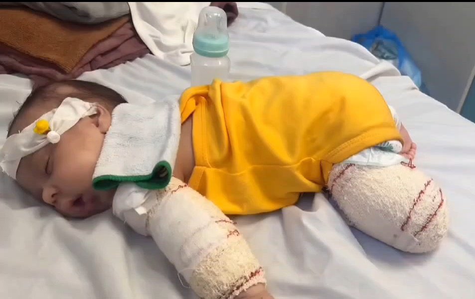 Help_Mazlum2's tweet photo. Israel did this!

Bunu İsrail yaptı!

Gazze’nin çocukları yaşasın 
#LetGazasChildrenLive yazıyoruz. https://t.co/fc1T3ECZY8