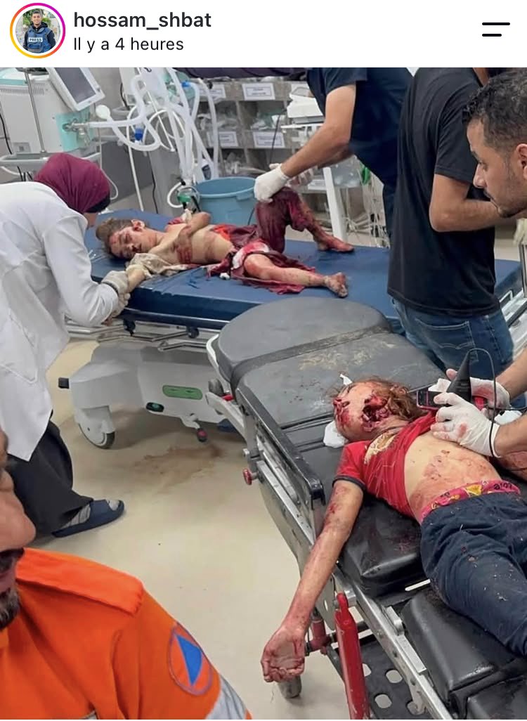 hothotZawalia's tweet photo. 10 blessés, pour la plupart des enfants, sont arrivés au complexe médical Al-Shifa suite au ciblage d'un drone suicide israélien qui a frappé un appartement résidentiel au nord du stade palestinien dans l'ouest de la ville de Gaza, selon les rapports initiaux. https://t.co/BQfo5LdxB4