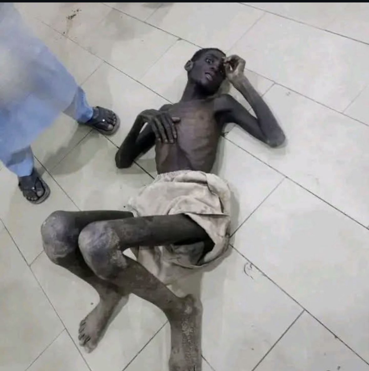 Scholarea's tweet photo. This is not a picture from a movie scene. This is a picture of severe malnutrition, hunger, pains and hopelessness melted on Nigerians by bandits/ terrorists mostly from the northern part of Nigeria. This is the reality of most vulnerable communities in the north. I’m sad 😔 https://t.co/x5jIRmKQes