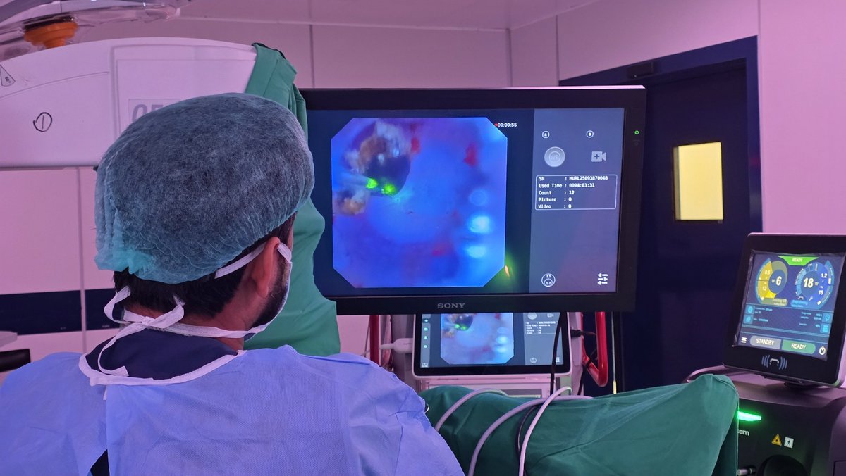 adeelanwaar3's tweet photo. @quanta_system laser #modulations and @ShenzhenHugeMed view never let you get bored in #RIRS. Switch freely between dusting strategies and adjust your settings according to stone composition, location, and procedural goals—unless you're keeping them fixed for a research protocol.
#RIRS #Urology #Endourology #LaserLithotripsy #HolmiumLaser #KidneyStones #StoneSurgery #FlexibleUreteroscopy #MedEd #SurgicalInnovation