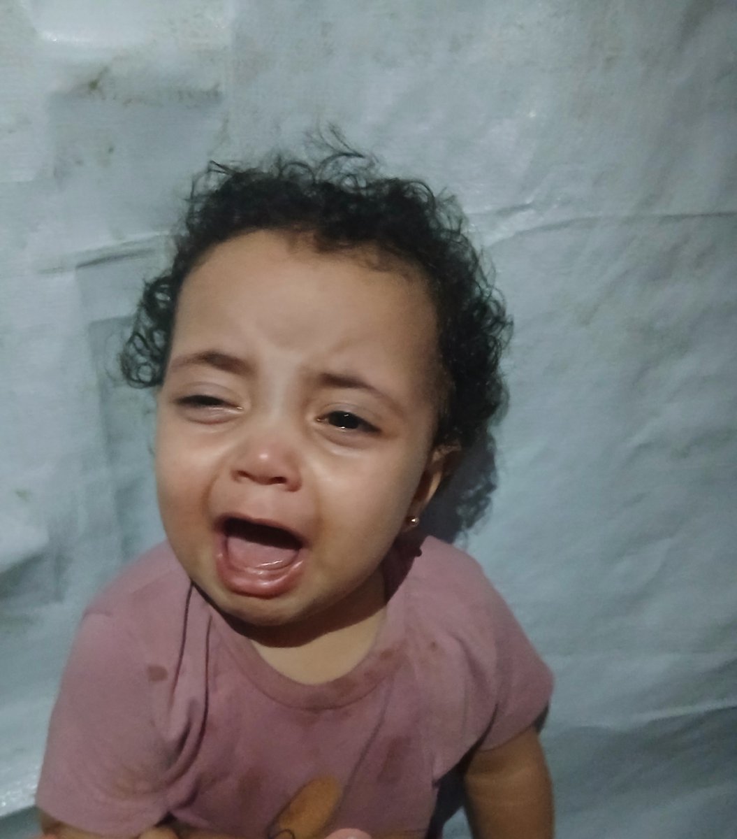HamadDaina63593's tweet photo. Every day I call out, but no one hears me. Why is this innocent little girl being ignored? 🥺
[https://t.co/XGVG8itcBL]⬅️
My little sister, Misk, urgently needs medication after a rash spread all over her body, but the cost of her treatment is beyond my means. 💔
Please help by donating or sharing this post. Your share could reach someone who can save her.🙏💔🥺
[https://t.co/XGVG8itcBL]⬅️