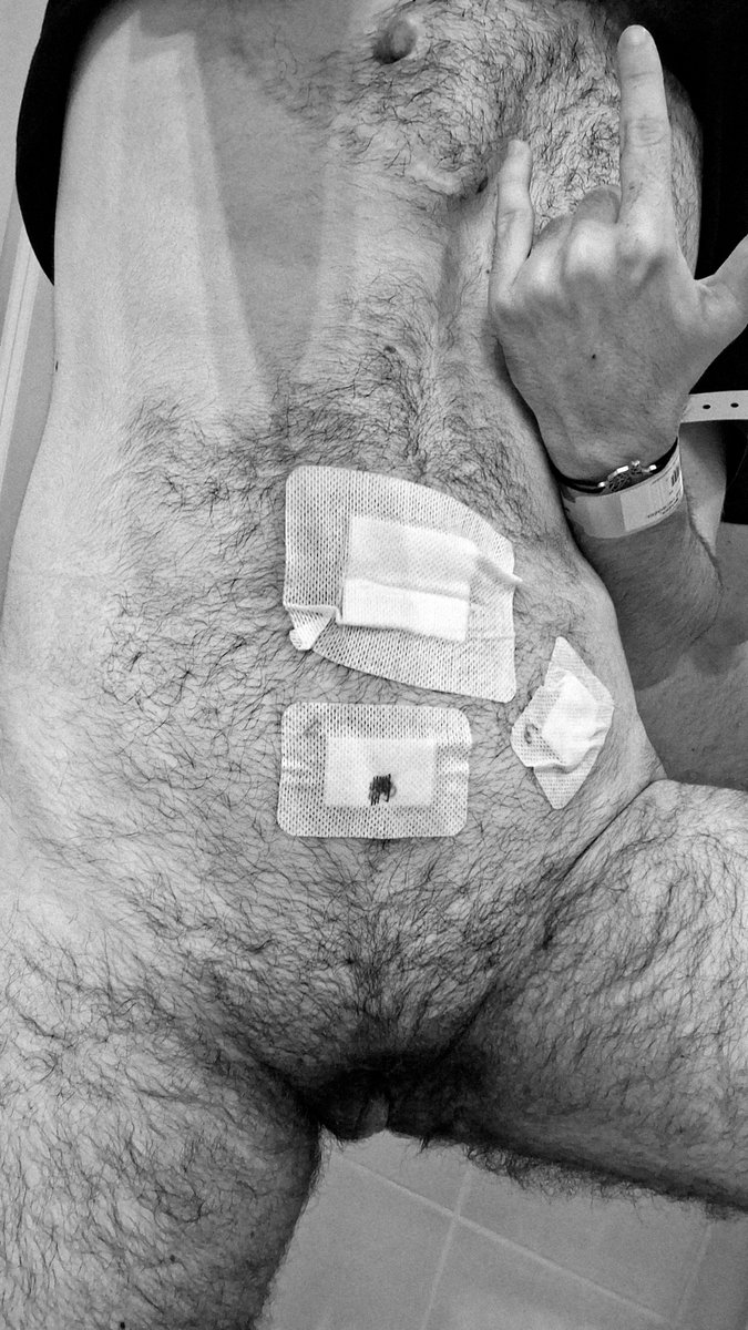 virgin_cuntboy's tweet photo. Hello everyone. I have big news.
I AM INFERTILE! At last, I am free! ๐ฅณ๐ฅณ๐ฅณ
#nsfw #nsfwtw #nsfwtrans #nsfwgay #onlyfans #gay #transman #ftm #bottom #cunt #slut #whore #naked #nude #masturbation #jockstrap #virgin #gayslut #porn #gayporn #transporn https://t.co/HVp3AtRvFG