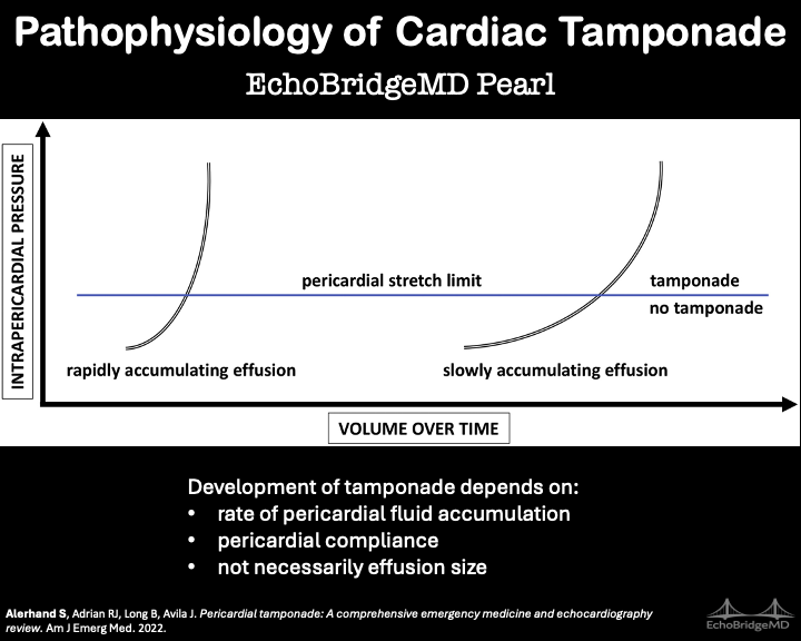 EchoBridgeMD's tweet photo. 𝗘𝗰𝗵𝗼𝗕𝗿𝗶𝗱𝗴𝗲 𝗣𝗲𝗮𝗿𝗹 𝟭𝟮

Cardiac tamponade depends more on the rate of fluid accumulation and pericardial compliance than on the size of the effusion.

It's not just how much fluid is present—it's how quickly it gets there.

#POCUS #Echo https://t.co/16VbKdNlEL