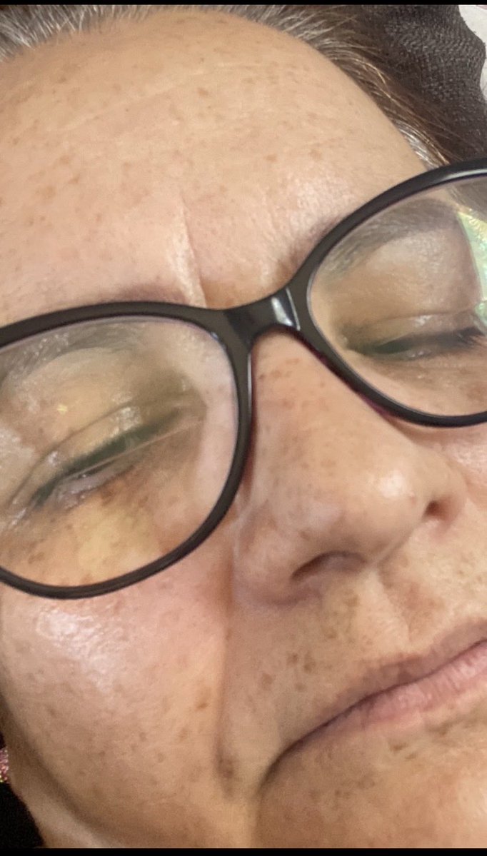 CieloYolandaBe1's tweet photo. 🆘UN GRITOOO DE AYUDA 🆘🙏👇🏻
Imagina vivir con un tumor cerebral que en cualquier momento te puede lanzar al piso con una convulsión…
Eso es mi realidad desde 2021.
28 sesiones de radioterapia y todavía sigo luchando sola.
Hoy necesito medicamentos y estudios urgentes.
Tu RT o tu ayuda (aunque sea mínima) puede ser la diferencia entre seguir de pie o caer.
Por favor, no pases de largo 🙏❤️‍🩹

CIELO YOLANDA BELTRAN SOTELO 
Cuenta: 6414896278  
CLABE: 021180064148962783  
Tarjeta: 4213166154571040  
Banco: HSBC  
Pay Pal cielobeltransky@hotmail.com