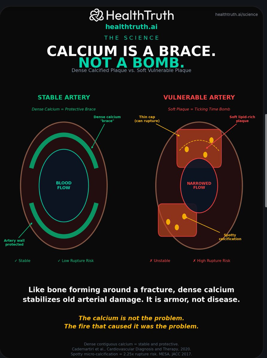 markkaplan20's tweet photo. My calcium score is over 1,000.

I have had 3 scans. The calcium has not moved.

I sleep like a baby.

Because I learned something my cardiologist never told me. Calcium in your arteries is not what kills you.

When your artery wall gets damaged by years of inflammation and insulin resistance, your body does what it always does. It repairs. It sends calcium to harden the damage. The same way bone forms around a fracture.

Dense calcium is a brace. A cast. Your body locking down old damage so it does not rupture.

Look at this image. Left side: dense calcium wrapping the artery wall. Stable. Protective. Blood flowing through. Right side: soft plaque with a thin cap ready to burst.

Your calcium score measures the brace. Not the bomb.