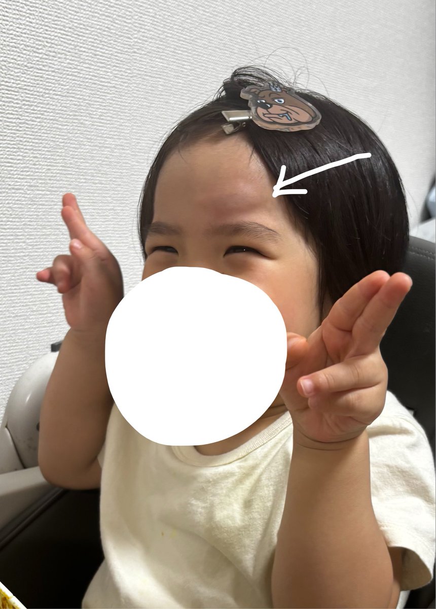 Sa_ya_too's tweet photo. 保育園帰ってきて、PaRiRa!のMV見たいっていうから見せながらご飯作ってたら、ソファの上で飛び跳ね回りまくってそのままおでこから落下してテーブルにゴン😂😂
めっちゃタンコブなって泣いてたけど、ローローのクリップでご機嫌になった、笑ったら目無くなる系男子のちびちゃむ(3)。笑 https://t.co/GxocL7wtnE