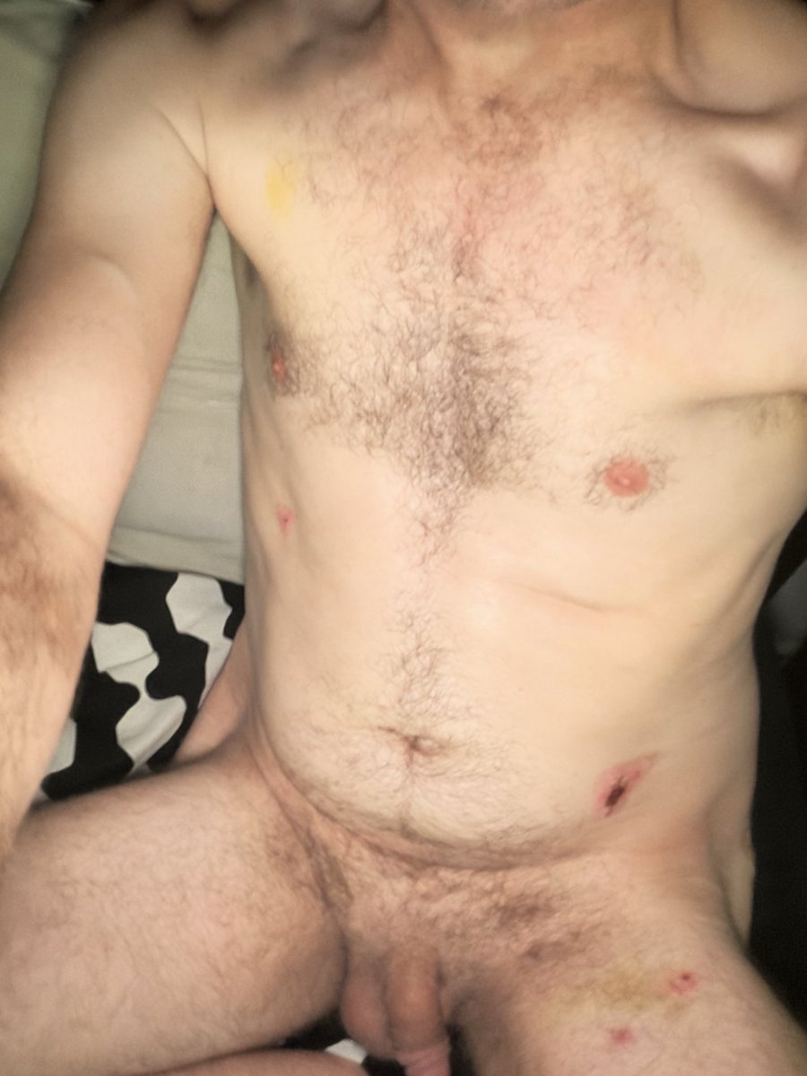 KapLex344923's tweet photo. Drugs and bathtub https://t.co/BRenkRU1uu