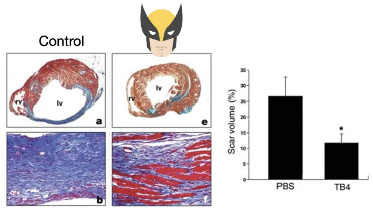 tb4 and bpc 157 Overall, 14 of 16 patients reported pain relief. Promising human signal? Yes. Proof that it works? Not without a legit randomized controlled trial. I would love to see a trial comparing the BPC-157 & TB-500 Blend For