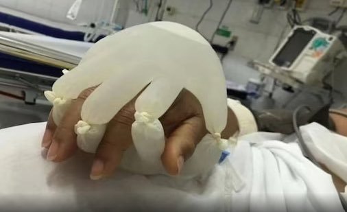 DrEliDavid's tweet photo. As late as 2021 some US hospitals were tying rubber gloves filled with hot water to dying people's hands, as they were denied family visits in their final moments.

Never forget the crimes they committed in the name of science. https://t.co/rm0NdwxiRX