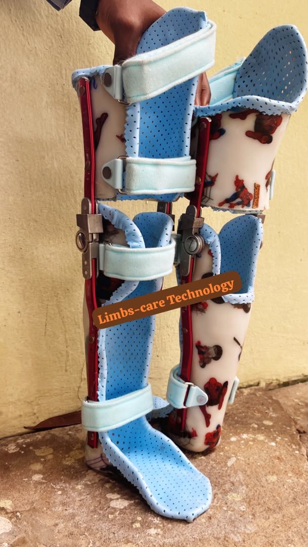 LimbsCare's tweet photo. Fabrication complete. 🦿✅

This KAFO is ready for fitting, alignment checks, and functional assessment.

Every detail matters when the goal is to improve stability, support, and mobility.
#KAFO #Orthotics #ProstheticsAndOrthotics #Rehabilitation https://t.co/A5okYSbyfL