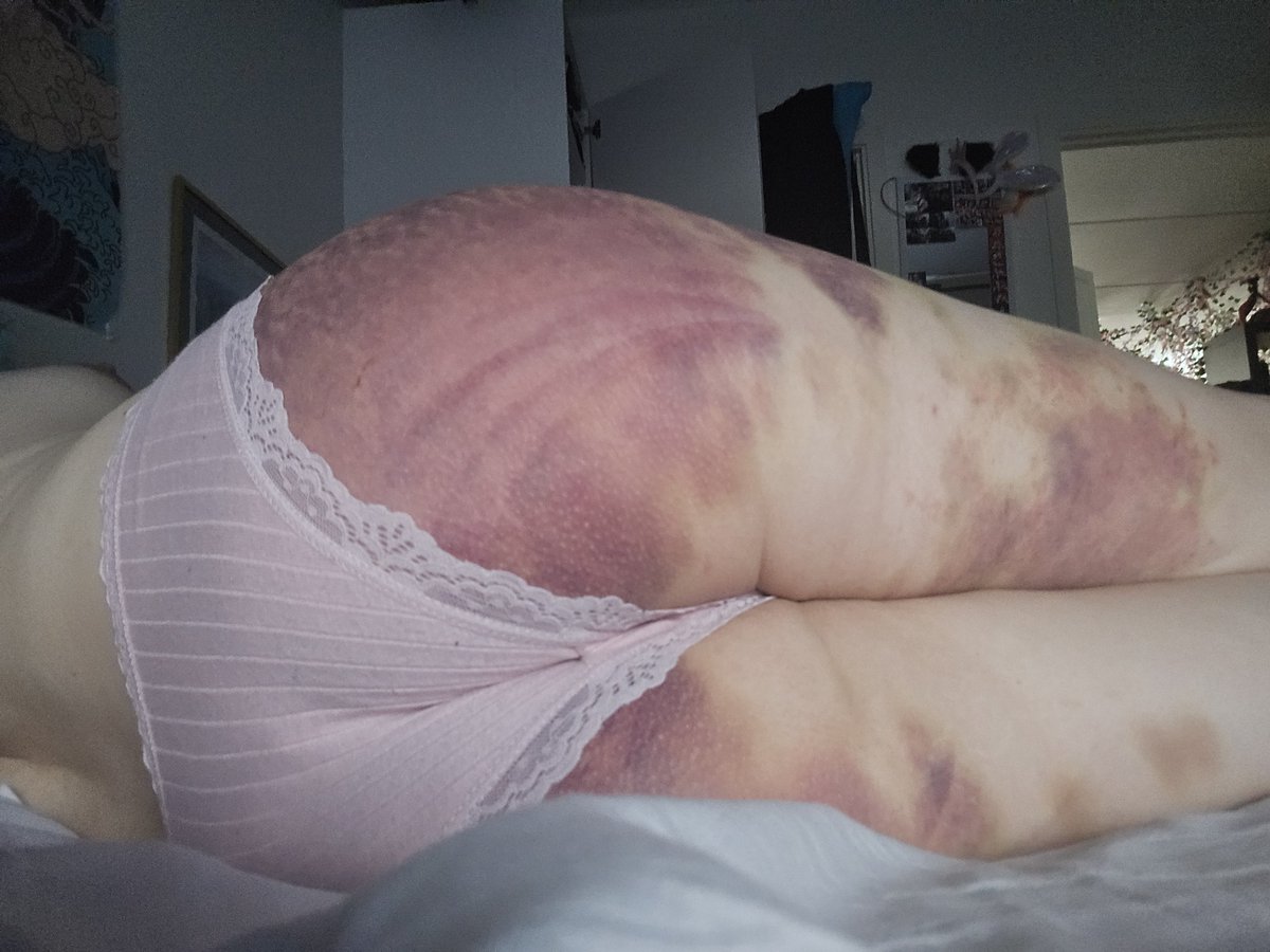 Bokhyllan01's tweet photo. everything hurts x.x https://t.co/xef5MBHXVA