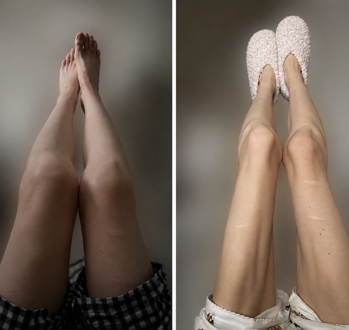 Mayafvuo's tweet photo. Blurred the background for privacy 🫣 but exactly 2months difference 
May 30th -> July 30th https://t.co/zHz2WjhqTU