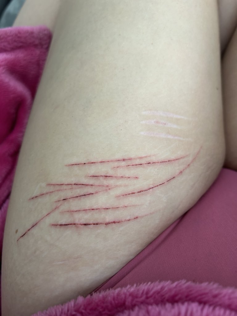 ST4RZST4RV3Z's tweet photo. Another day another relapse
#988twt #shtwt #shedrtwt https://t.co/JtwSbOjJcg