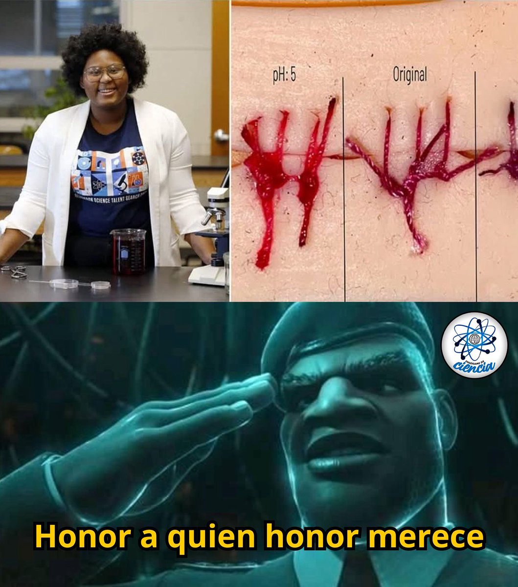 EnsedeCiencia's tweet photo. Con solo 17 años, Dasia Taylor demostró que no hacen falta millones ni laboratorios futuristas para cambiar el rumbo de la ciencia… solo ingenio y una remolacha. 🥬✨

Mientras otros adolescentes hacían tareas comunes, ella descubrió algo increíble: suturas que cambian de color para detectar infecciones antes de que sea demasiado tarde. 😱

El secreto está en el pigmento natural del jugo de remolacha, que actúa como un sensor de pH.
Cuando la piel está sana (pH 5), el hilo luce rojo brillante, pero si la herida se infecta (pH 9)… el color se transforma en morado oscuro, ¡una señal de alerta inmediata! ⚠️

Taylor creó estas suturas usando fibras seguras y biocompatibles, pensadas especialmente para comunidades sin acceso a equipos médicos avanzados. 🌍❤️

Su invento la llevó a ser finalista del prestigioso Regeneron Science Talent Search, y su nombre ya resuena entre los futuros innovadores que podrían salvar miles de vidas con ciencia simple, accesible y brillante. 🏅🧠

🔥 Una joven que podría revolucionar la medicina para siempre. 💪