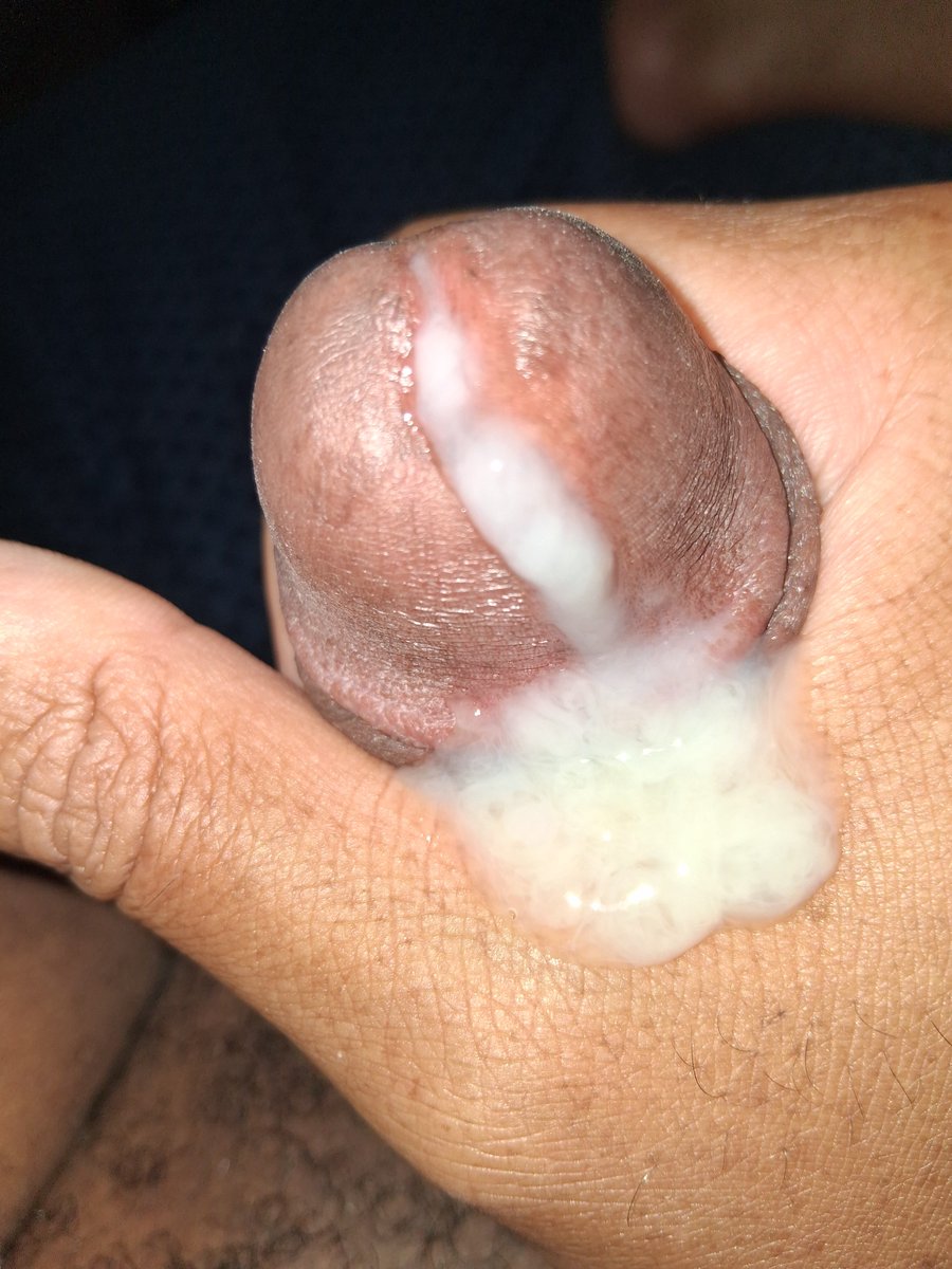 VolcanoD3's tweet photo. Ewww https://t.co/BQbghSRnEM