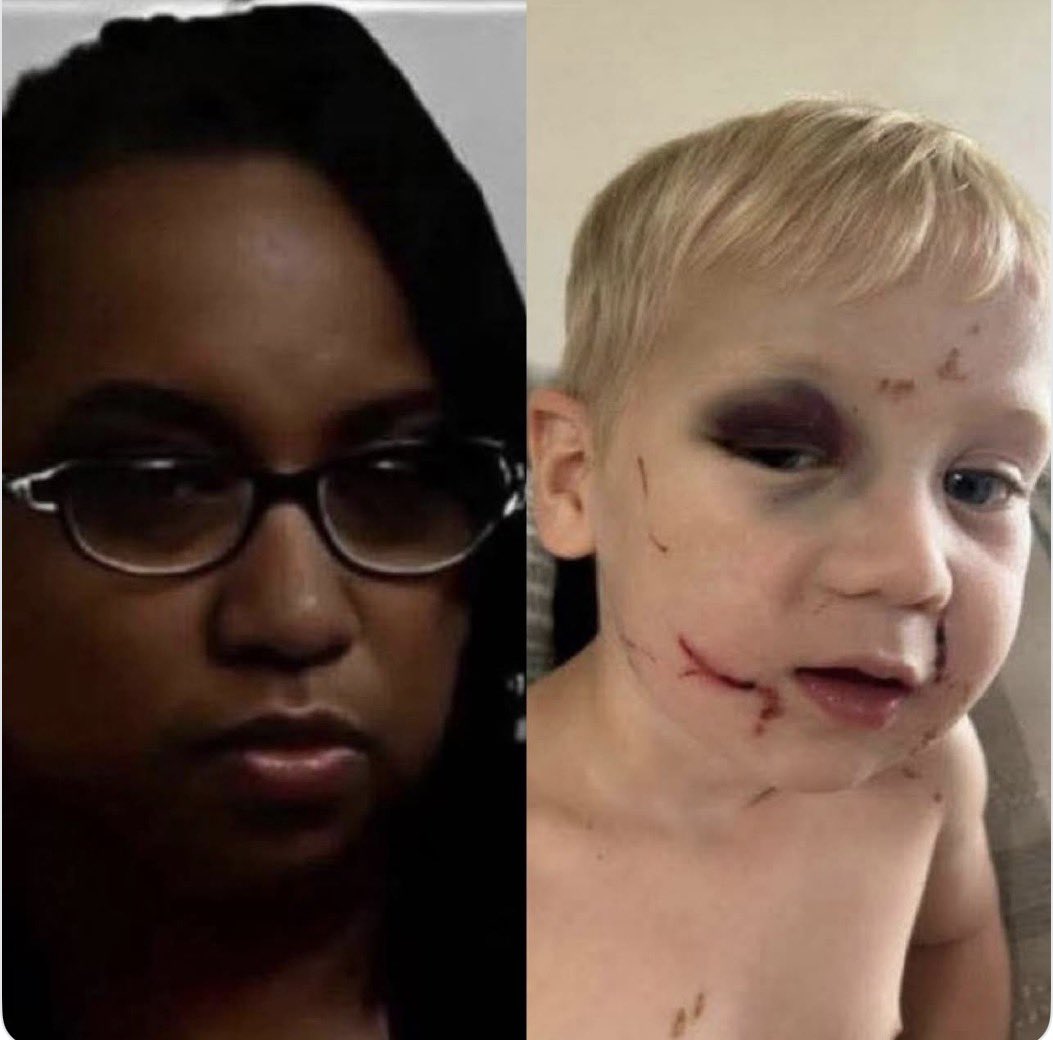 A_WhiteGenocide's tweet photo. Yvette Thurston punched a baby in the face over and over at Little Blessings Child Care in Bainbridge, GA.

Staff covered for her and blamed another kid. 

Cameras exposed the lie.

She walked free on bond. A bond that was only 44,000

If that baby were black, every network would be screaming about it for weeks.

But when the victim is White? 

Silence. Selective coverage. Selective outrage.

They’re not against child abuse. 

They’re against the wrong kind of victim.

This is the pattern.