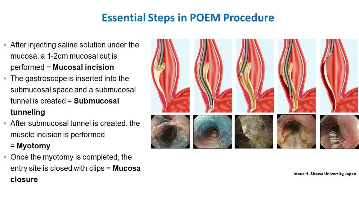 EndoCollab™ | GI Endoscopy Community tweet media