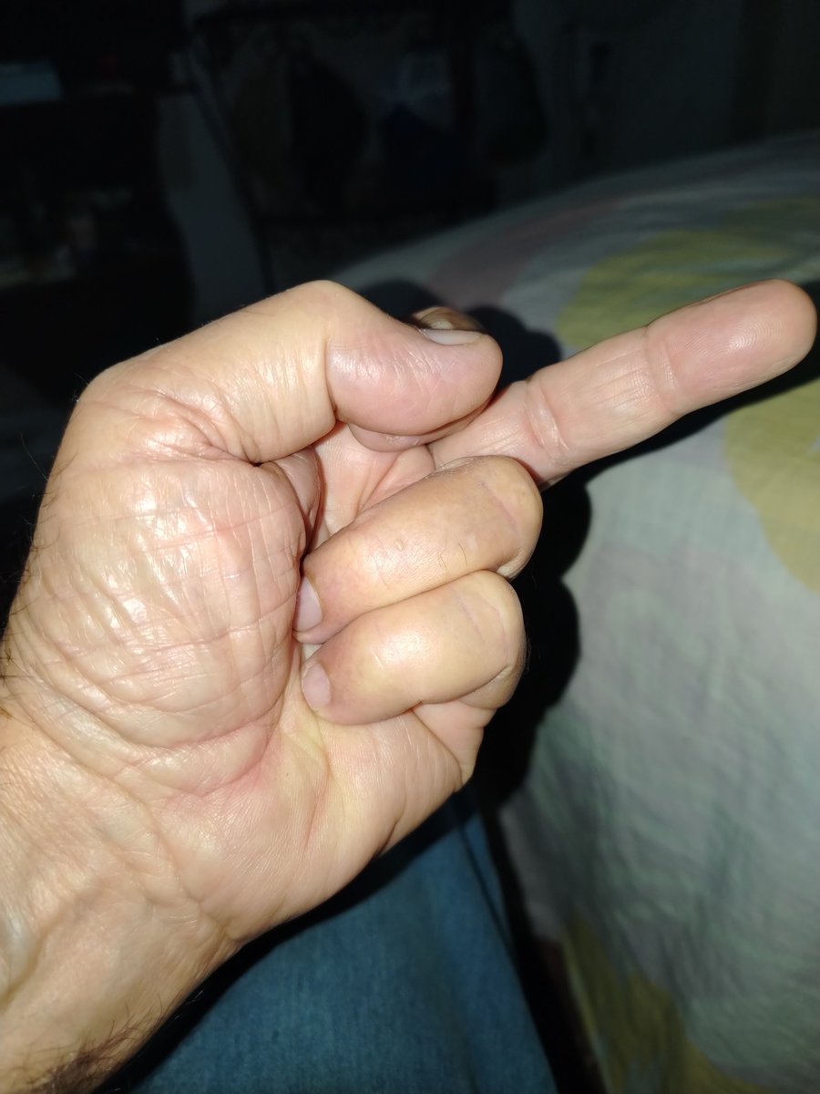 refrigerista's tweet photo. @ConElMazoDando @dcabellor https://t.co/k9hmyJdNNy