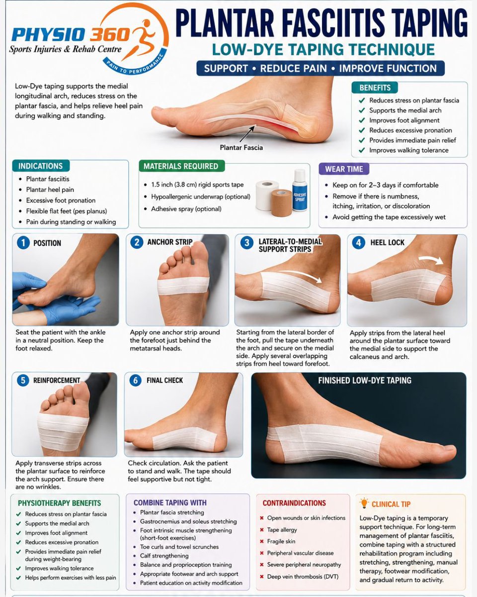 physio360centre's tweet photo. Physiotherapy Benefits
Reduces stress on the plantar fascia
Supports the medial arch
Improves foot alignment
Reduces excessive pronation
Provides immediate pain relief during weight-bearing
Improves walking tolerance
Helps patients perform exercises with less pain. https://t.co/mCoxYl4wp0