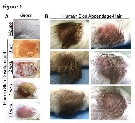 ihearu888's tweet photo. Don't forget about the humanized mice! The grafted human hair comes from aborted 5 month old babies. Was SARS-COV-2 engineered at University of North Carolina Chapel Hill lab and transported to Wuhan lab for gain-of-function research? Did the Wuhan lab experiment on a virus that was engineered in a U.S. laboratory?