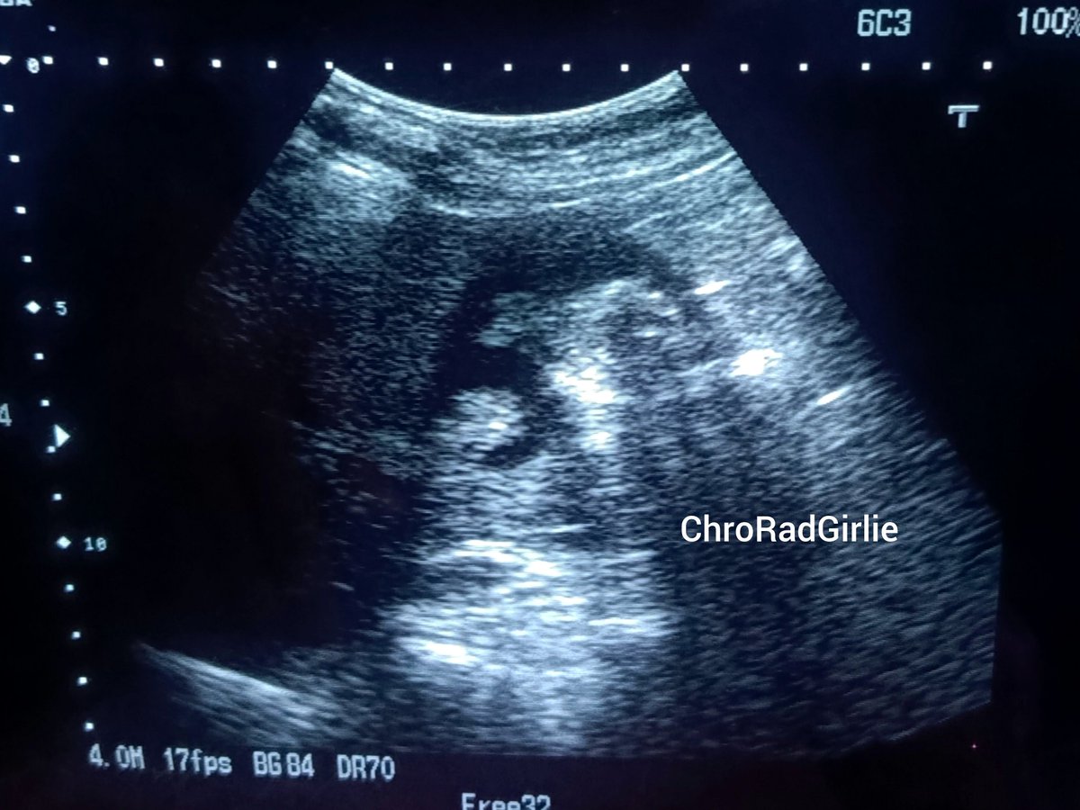 ChroRadGirlie tweet media