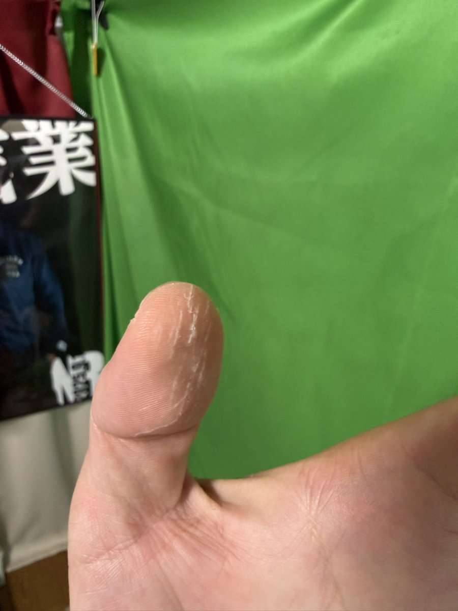 ICCHY8591's tweet photo. うとうとしてたら、痛ッて気づいて親指見たらズタズタに切れてたんだけど、、、 https://t.co/fGJGUA89AH