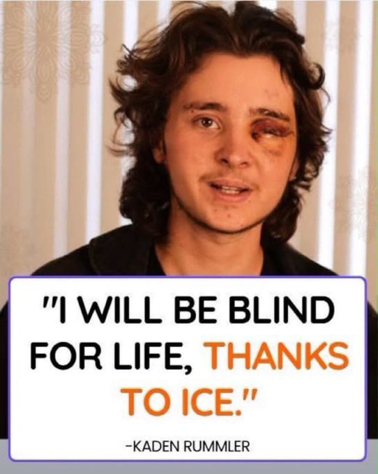 0JeaninePirro's tweet photo. Was ICE justified in what they did to this leftist protester who was throwing stuff at them ??

A. YES
B. NO https://t.co/22C7wo4tHz