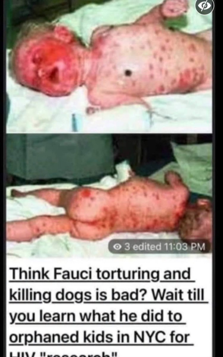 SmolfSmolf7's tweet photo. I have read about it and that 200 children are buried there from his experiments that he was doing for AIDS medication. The medication made the children so sick that they refused to take it so he put tubes in their stomach to force feed them! Then the evil little man took it out to the gay population, and said everything was their fault needed to take these drugs, or they were going to die, and basically the drugs were killings them from what I understand! The whole thing was a sham just like Covid! Extremely evil and then not to mention what he did the beagles dogs, tortured them to death!  ￼￼ Thank God in heaven, these demonic souls are being removed from the Earth!￼