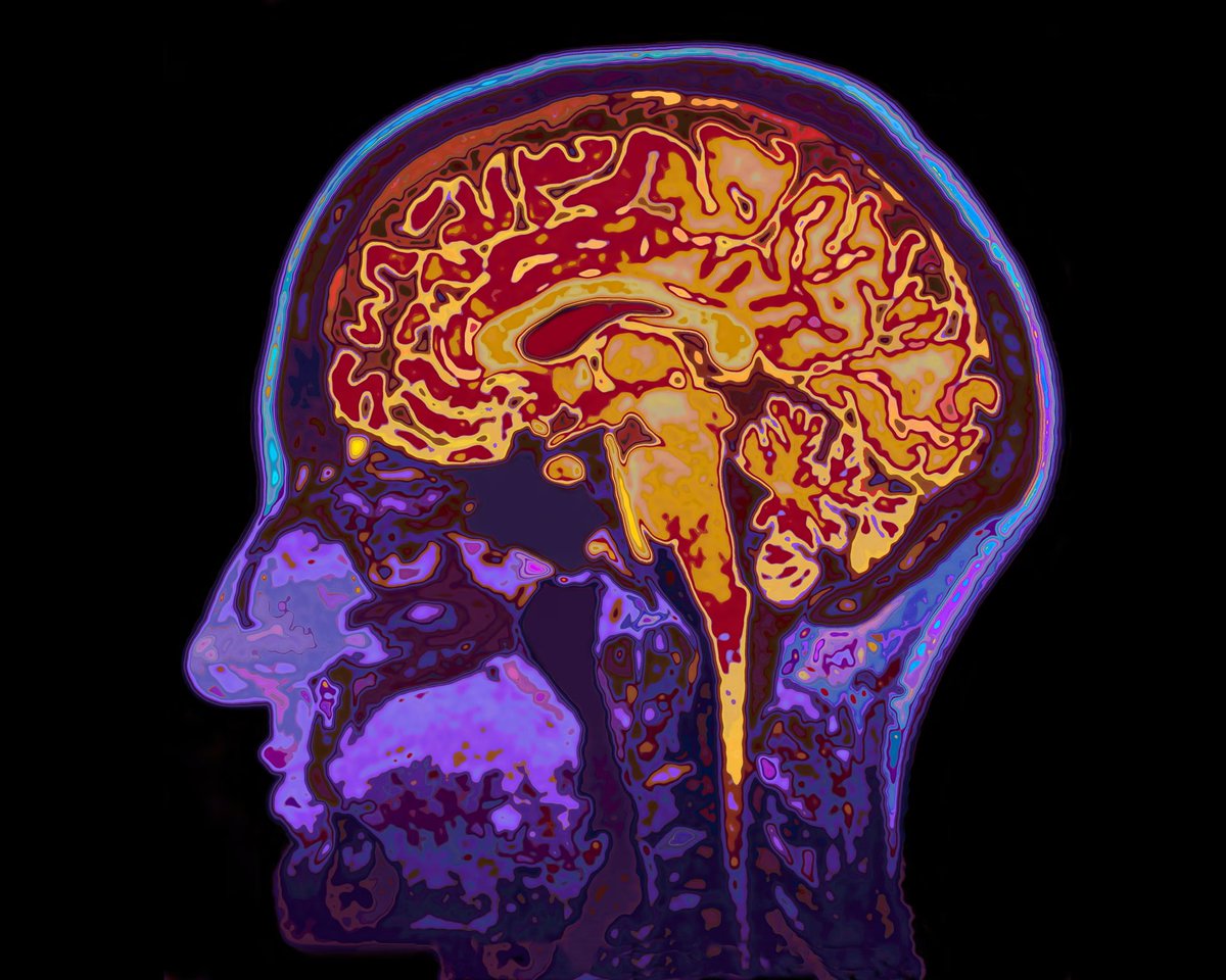 latestincosmos's tweet photo. JUST IN🚨: A real life experiment shows our minds can adversely affect our health, and scientists are increasingly showing that negative thoughts can produce very real symptoms. https://t.co/EHyBsEJ73W