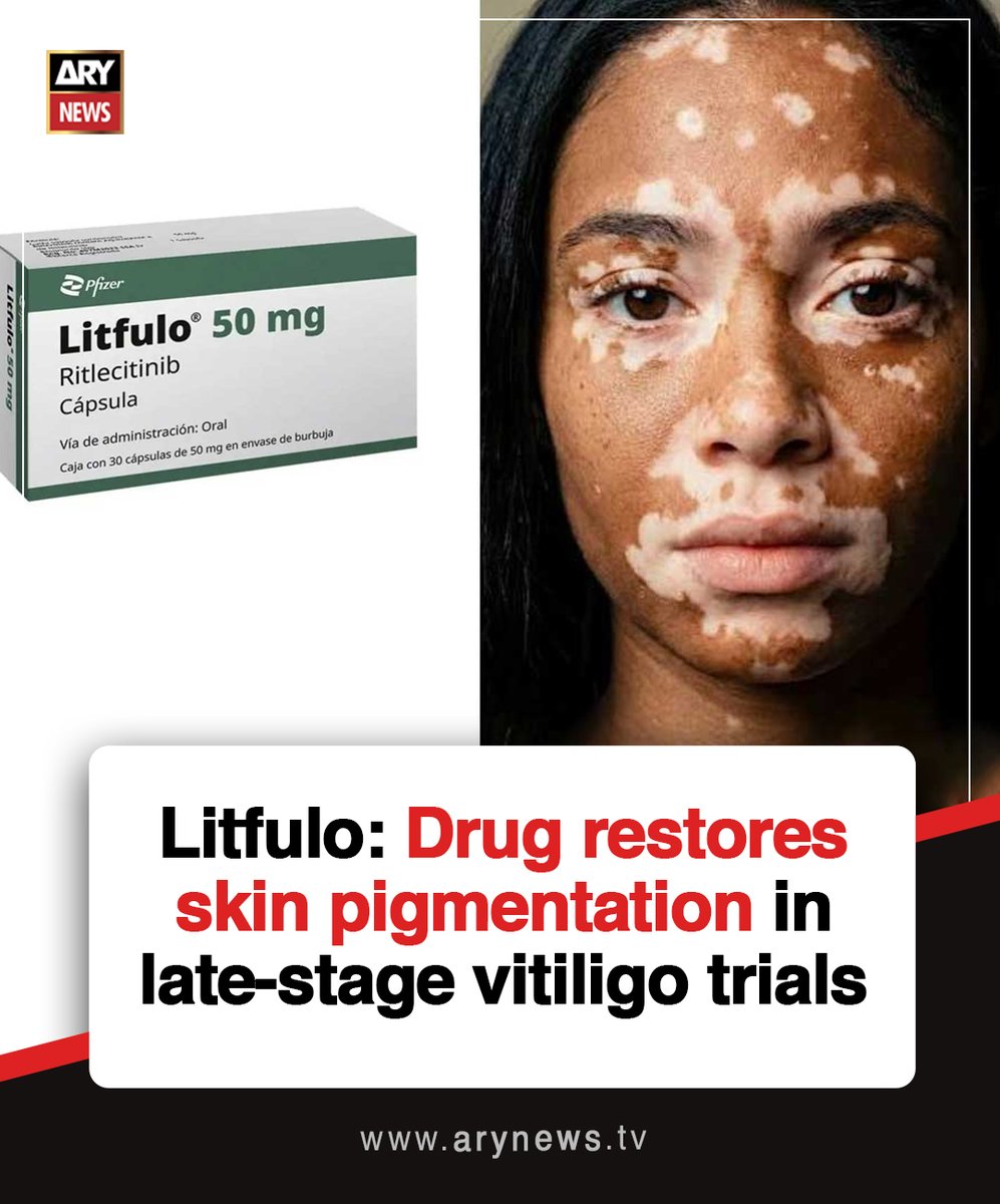 ARYNEWSOFFICIAL's tweet photo. Litfulo: Drug restores skin pigmentation in late-stage vitiligo trials

More details: https://t.co/Zc3MVa5LtE

#ARYNews https://t.co/oUM4HN5r4l