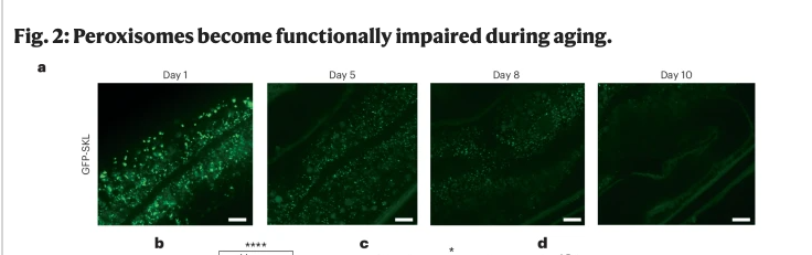 ProdromeScience's tweet photo. Such an interesting article one of our team members came across today:
https://t.co/QRLeK5RL0I

"Mitochondrial fragmentation and bioenergetic collapse are induced on peroxisome import dysfunction"

We’re obsessed with peroxisomal function here. What if one of the cascades of mitochondrial dysfunction starts from peroxisomal dysfunction? 

We're seeing more of this research. Supporting peroxisomal health indicates a happy downstream side effect for the mitochondrial systems perhaps...