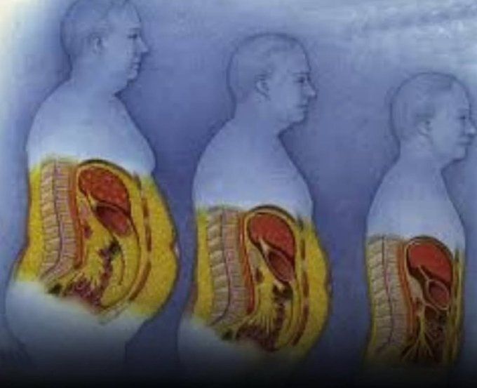 valormental's tweet photo. PERDER GRASA ES LO MAS FACIL DE EL MUNDO.

Te hicieron creer que era complicado vendiéndote programas y dietas interminables.

Aquí tienes 8 trucos basados en la evidencia que usé para bajar 9 kilos en 65 días: https://t.co/Kt3Rv369x8