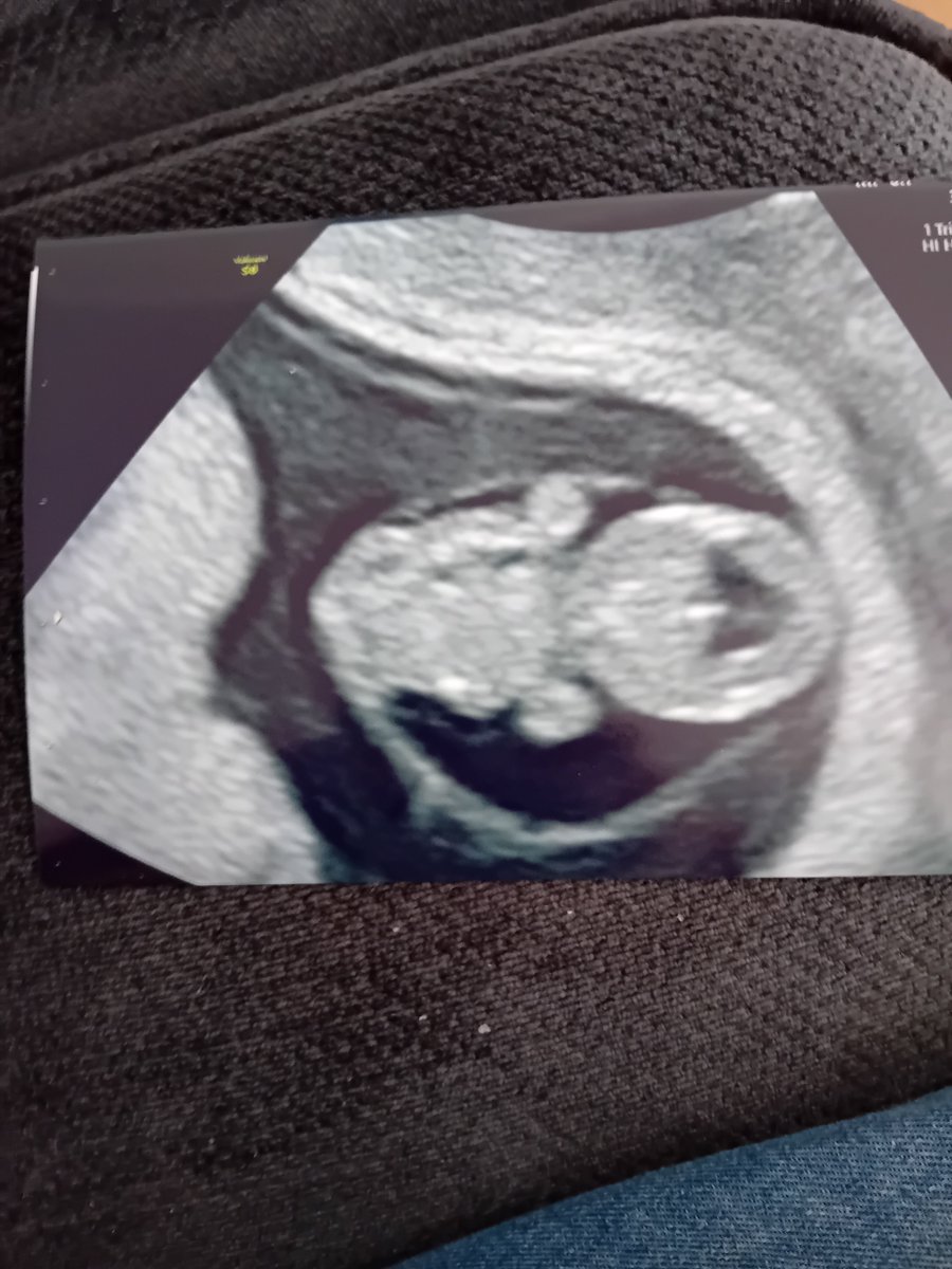 NicG_nufc's tweet photo. Anyway, this cheered me up today! ♥️ #grandbaby https://t.co/OJbuj5uPLv