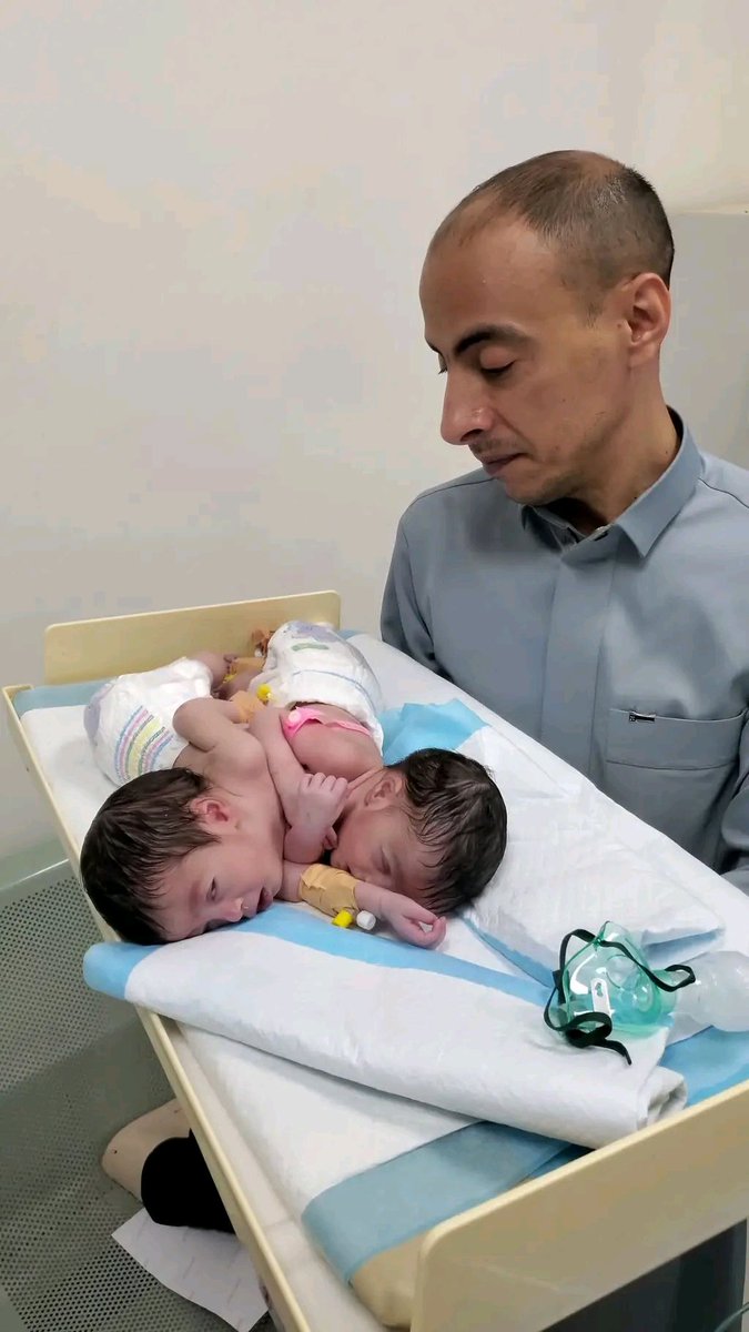 albahriaboali's tweet photo. مالها الا مناشدة لمركز الملك سلمان بن عبدالعزيز ال سعود لعلاج وفصل توأم ملتصق
هم أهل للخير وسباقين لفعل الخير لمثل هذه الحالات
وان شاء الله انها توصل لهم هذه الحالة https://t.co/26LhTsZYtM