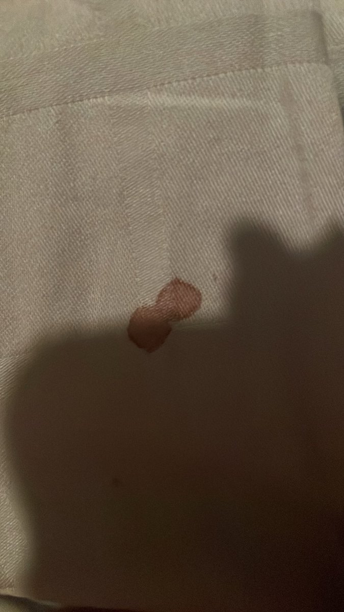 ang3liceve's tweet photo. Guys is this a blood stain??

#shrtwt #ouchietwt #slittwt https://t.co/CkgQw2dnnj