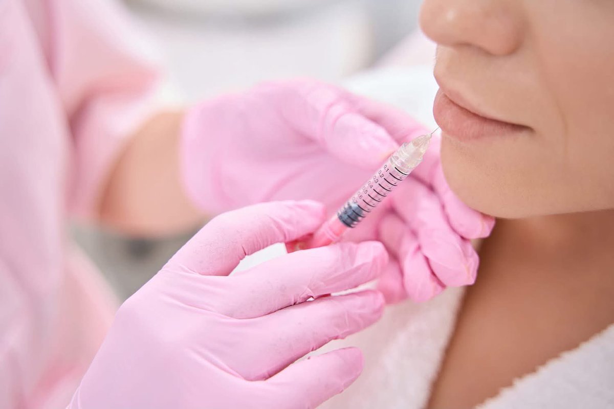 FlaviusKlinikle's tweet photo. Hyaluronik asit kolajenden daha pahalıdır ancak nazolabial kıvrımlarda altı aya kadar daha uzun süre dayanır. Botulinum toksini enjeksiyonlarında olduğu gibi dermal dolgu enjeksiyonlarının etkisi de birkaç ay sonra kaybolmaya başlar. https://t.co/6MD2kVXHup