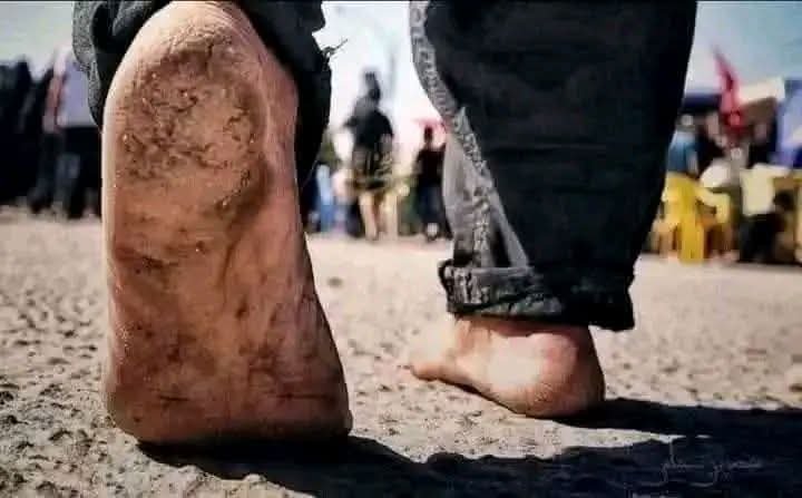 jafarrazarizvi's tweet photo. سلام اُن عظیم پیروں پر جو قبر حسینؑ کی طرف بڑھ رہے ہیں https://t.co/MkxyC8IFCw