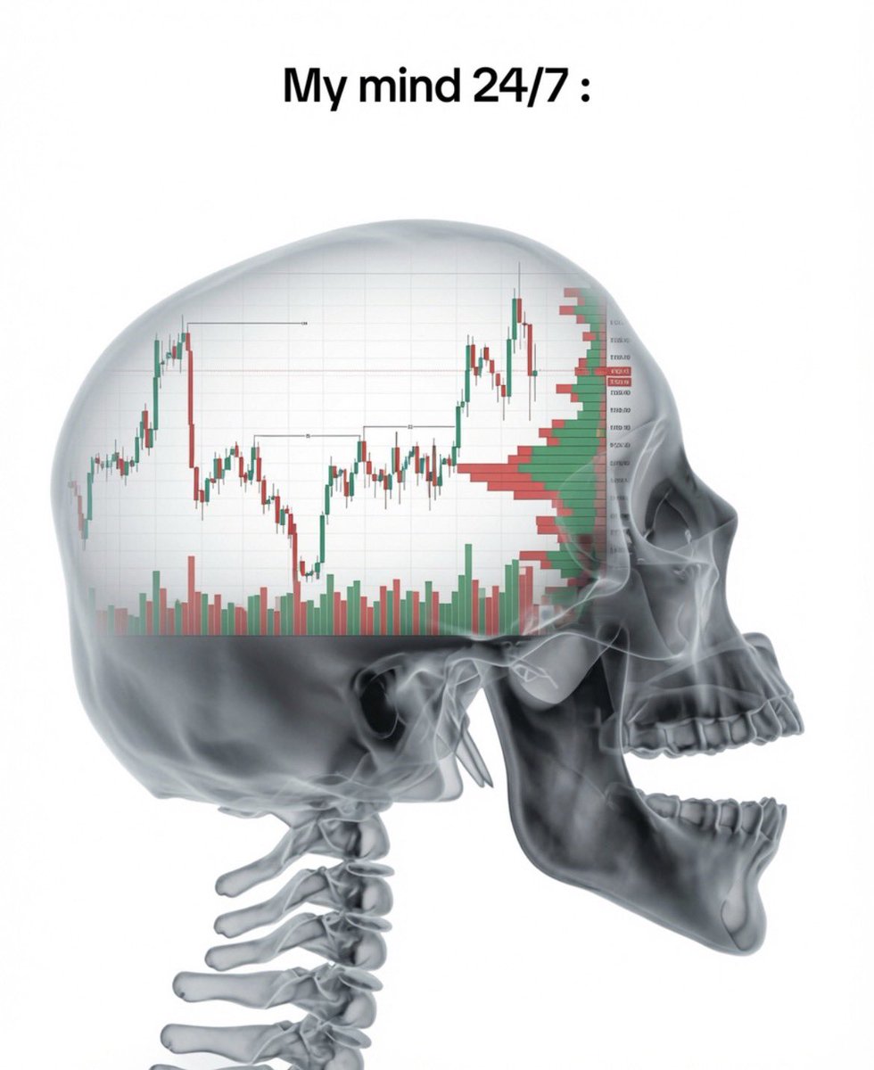 SJosephBurns's tweet photo. X-ray of my brain: 🧠 https://t.co/iep2kF0yvQ
