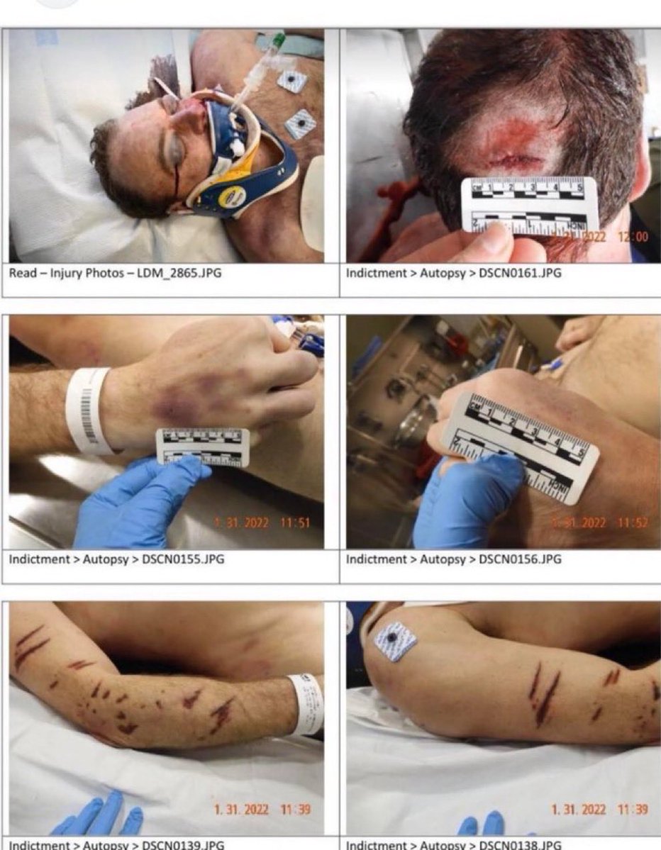 catwoman_1111's tweet photo. @kelly_steffee Well anyone w 1 brain cell knows #JohnOkeefe was bit by K9 beaten to death ! it’s not rocket science but why they are pretending it was taillight w no blood no tissue no DNA and trolls believe it ..is ridiculous #fkr https://t.co/zAItImF00X