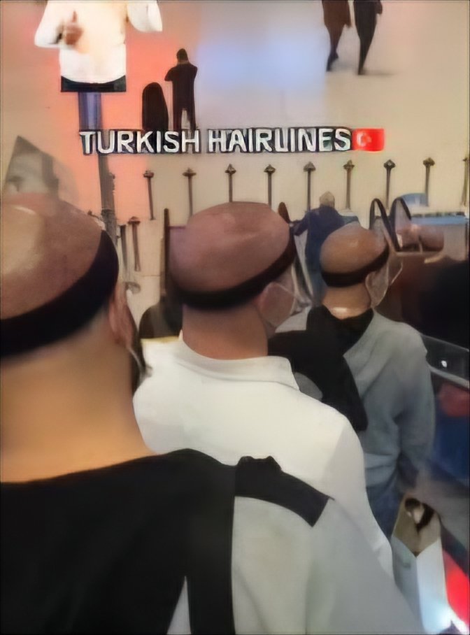 OrkunIz's tweet photo. Türkiye olarak Erkeklerin kelliğine çözüm bulma konusunda'da iddialıyız https://t.co/FVyREGGxcM