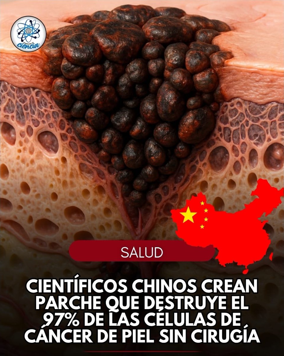 EnsedeCiencia's tweet photo. Un equipo de investigadores de la Universidad de Hong Kong y la Universidad de Wuhan han desarrollado un posible nuevo tratamiento para tratar el melanoma de una manera no invasiva. Consiste en un parche elástico que se activa mediante calor, muy parecido a una venda. https://t.co/oDHX0CxQd6